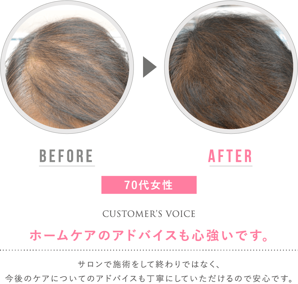 before after