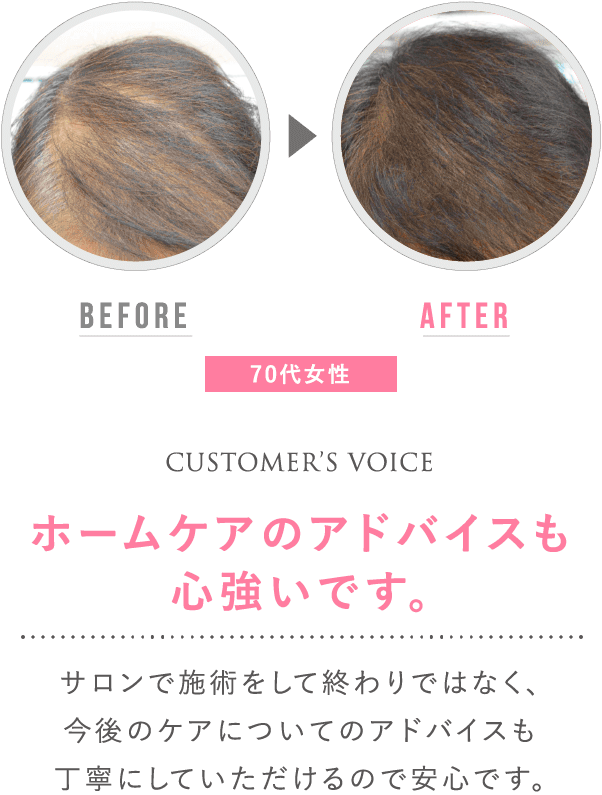 before after