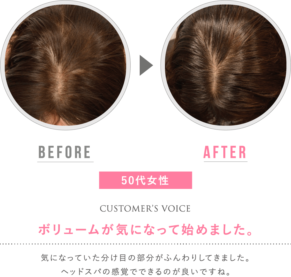 before after