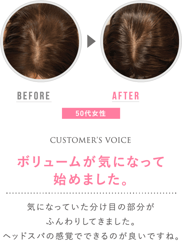 before after