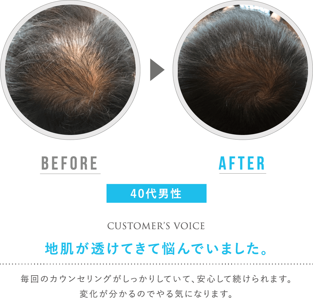 before after