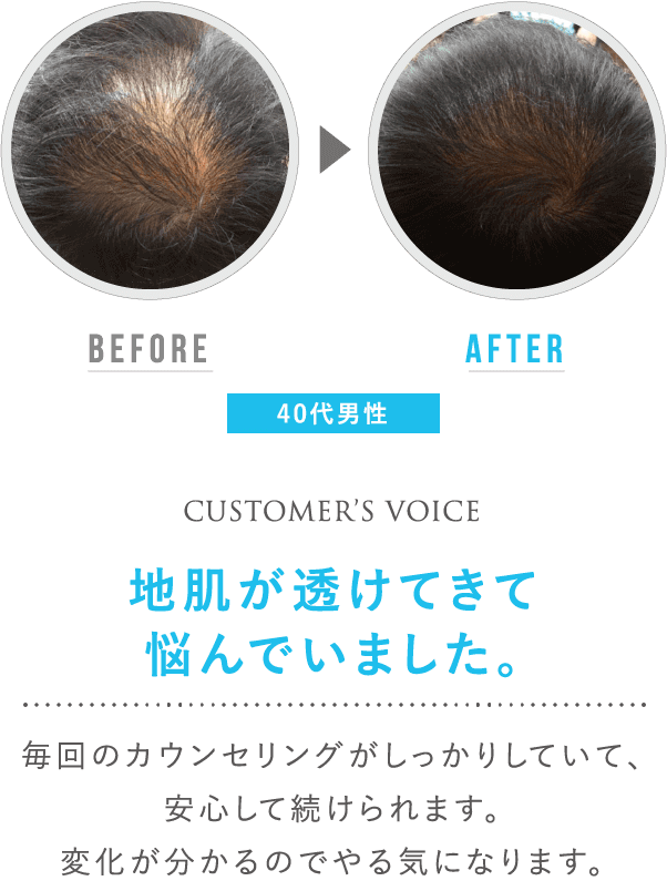 before after